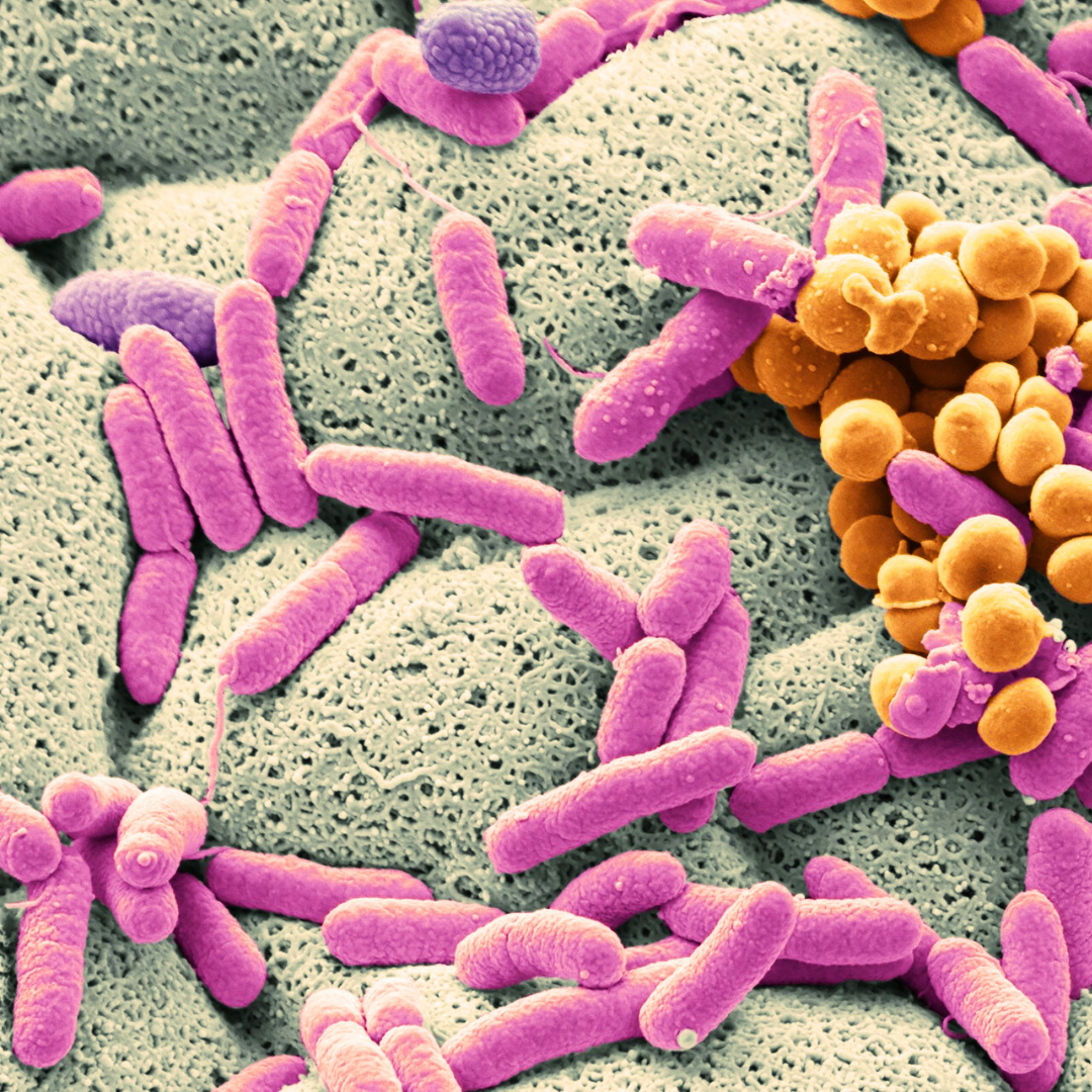 salmonella spp